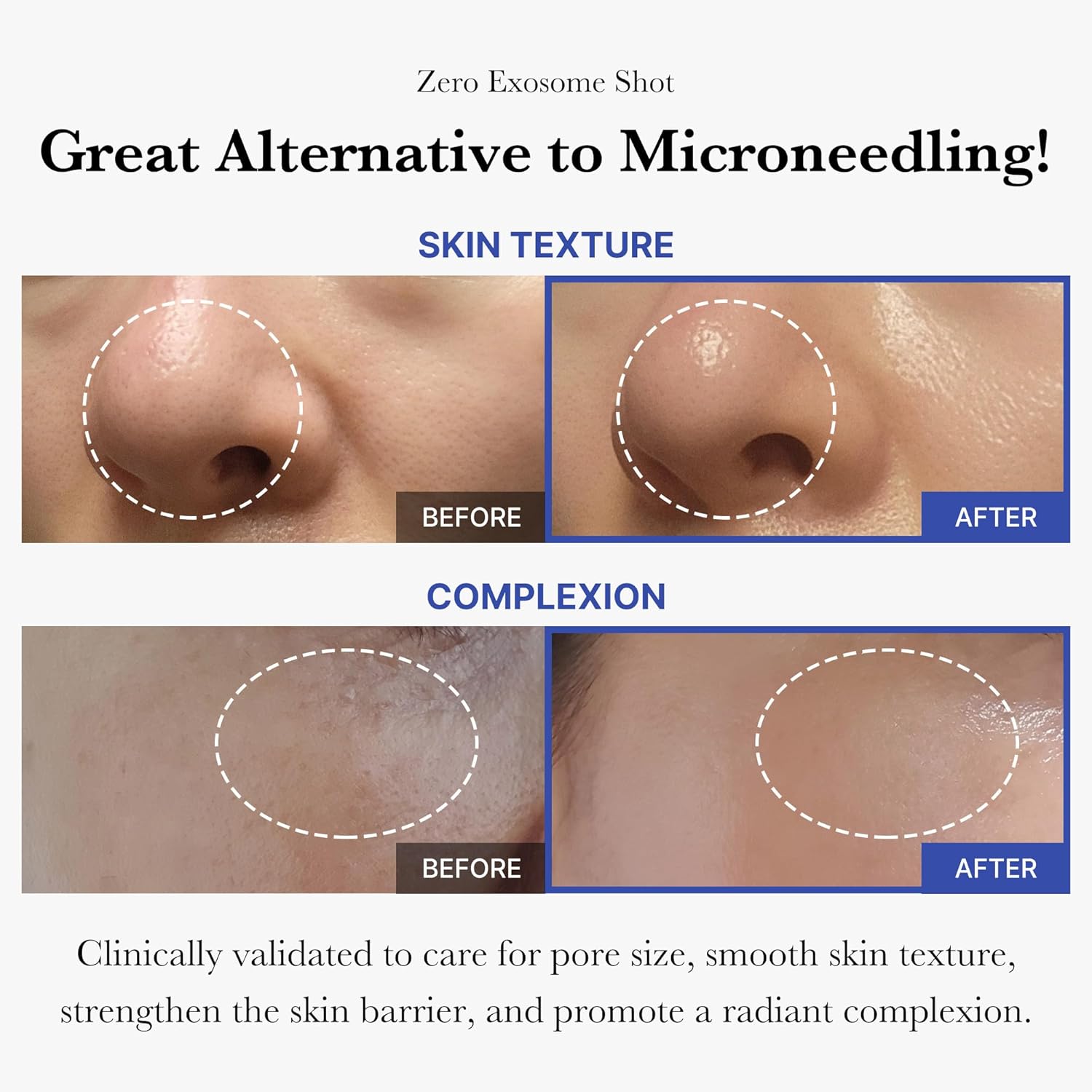 Zero Exosome Shot | Medicube