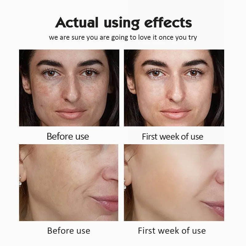 Αμπούλες 20% Βιταμίνης C για Λάμψη και Αντιοξείδωση