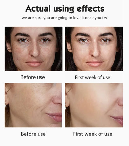 Αμπούλες 20% Βιταμίνης C για Λάμψη και Αντιοξείδωση